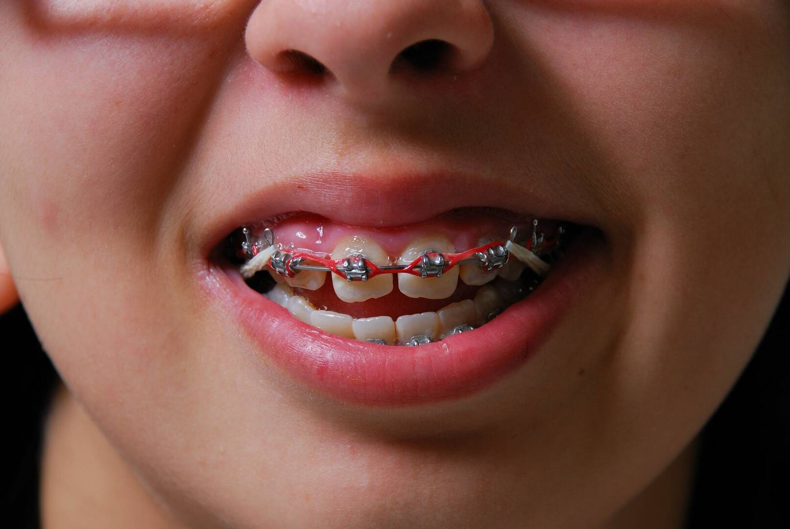 Bernuy Orthodontic Specialist