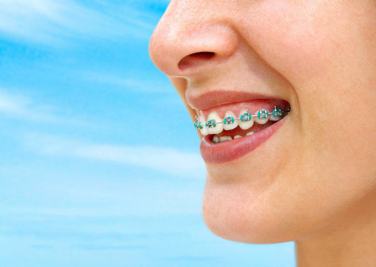 Katz Orthodontics: Mark J. Katz, DDS,MSD, PA